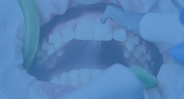 Estetica e Igiene Dentale