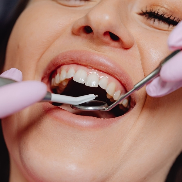 Estrazione dentale professionale