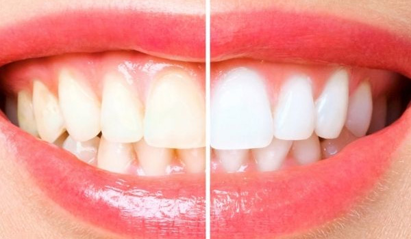 Follow-up organizzato